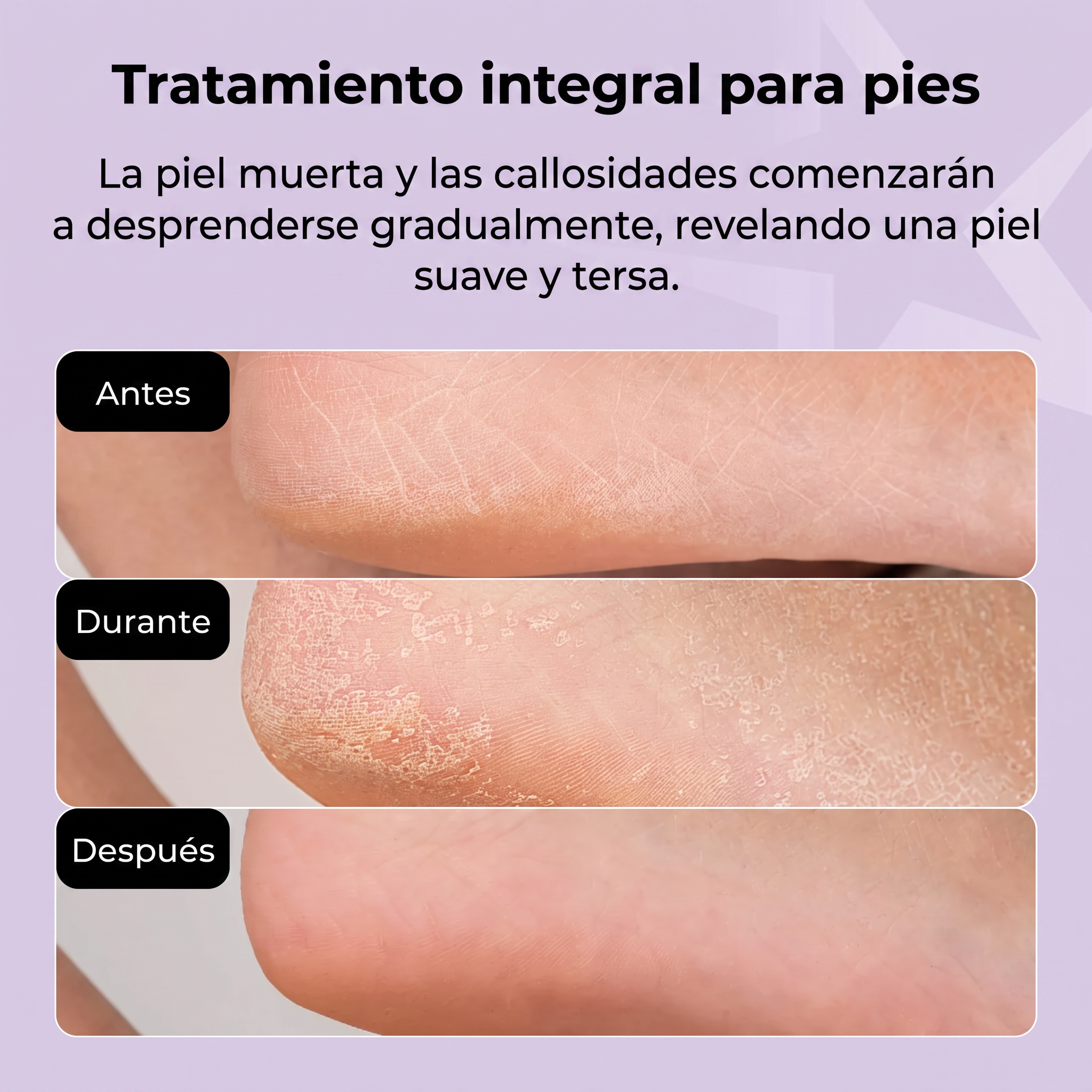 STARSKIN Magic Hour Foot Mask - Calcetines Exfoliantes para Pies - BeautifyBox